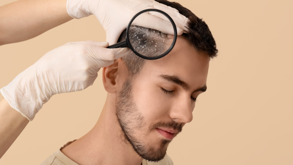 Demodex in the scalp of man having scalp examined with magnifier